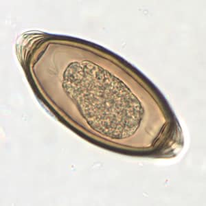 Figure C: Egg of <em>T. trichiura</em> in an unstained wet mount.