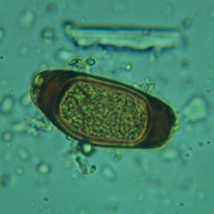 Figure A: Atypical egg of <em>T. trichiura</em>.
