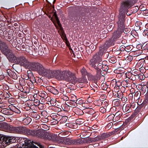 Figure A: Cross-section of a gravid female <em>T. trichiura</em> stained with Hamp;E, showing numerous eggs. Magnification at 100x. Image courtesy of the Oregon State Public Heath Laboratory.