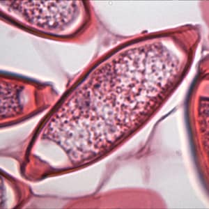 Figure B: Same specimen as in Figure A but at 1000x magnification, showing a close-up of one of the eggs.