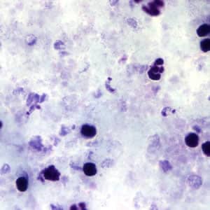 Tcruzi_thick_giemsa.jpg Figure A: <em>T. cruzi</em> trypomastigotes in a thick blood smear stained with Giemsa.