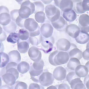 Tcruzi_thin_giemsa.jpg Figure A: <em>T. cruzi</em> trypomastigote in a thin blood smear stained with Giemsa. Note the typical C-shape of the trypomastigote that characterizes T. cruzi in fixed blood smears.