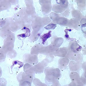 Tcruzi_thin_giemsa2.jpg Figure B: Three <em>T. cruzi</em> trypomastigotes in a thin blood smear stained with Giemsa.