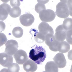 Tcruzi_thin_giemsa3.jpg Figure C: <em>T. cruzi</em> trypomastigote in a thin blood smear stained with Giemsa.