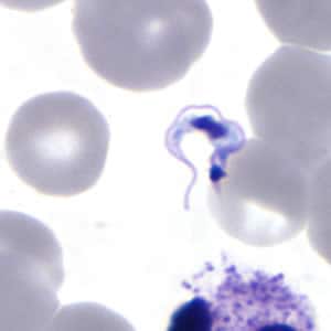 Tcruzi_thin_giemsa3_zoom.jpg Figure E: Higher magnification of Figure C, <em>T. cruzi</em>.