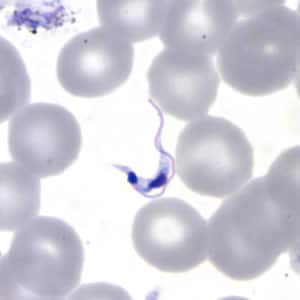 Tcruzi_thin_giemsa_subt.jpg Figure D: Higher magnification of Figure C, <em>T. cruzi</em>.