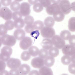 Tcruzi_thin_giemsa4.jpg Figure A: <em>T. cruzi</em> trypomastigote in a thin blood smear stained with Giemsa.