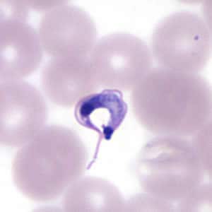 Tcruzi_thin_giemsa4_zoom.jpg Figure B: Higher magnification of Figure A, <em>T. cruzi</em>.