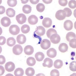 Tcruzi_thin_giemsa5.jpg Figure C: <em>T. cruzi</em> trypomastigote in a thin blood smear stained with Giemsa. Note the more anterior location of the nucleus.