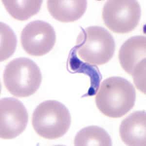 Tcruzi_thin_giemsa5_zoom.jpg Figure D: Higher magnification of Figure C, <em>T. cruzi</em>.