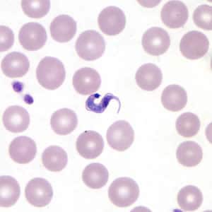 Tcruzi_thin_giemsa6.jpg Figure E: <em>T. cruzi</em> trypomastigote in a thin blood smear stained with Giemsa.
