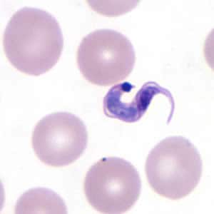 Tcruzi_thin_giemsa6_zoom.jpg Figure F: Higher magnification of Figure E, <em>T. cruzi</em>.