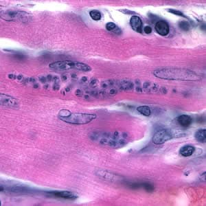 Tcruzi_tissue_he2.jpg Figure C: <em>Trypanosoma cruzi</em> amastigotes in heart tissue. The section is stained with H&E.