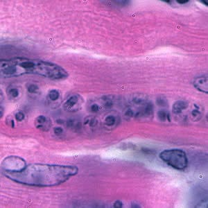 Tcruzi_tissue_he2_zoom.jpg Figure D: Higher magnification of Figure C.