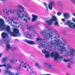 Tcruzi_tissue_he3.jpg Figure E: <em>Trypanosoma cruzi</em> amastigotes in heart tissue. The section is stained with H&E.