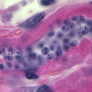 Tcruzi_tissue_he_zoom.jpg Figure B: Higher magnification of Figure A.