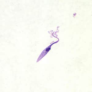 Tcruzi_culture_epi.jpg Figure A: <em>Trypanosoma cruzi</em> epimastigote from culture. Note the location of the kinetoplast anterior to the nucleus.
