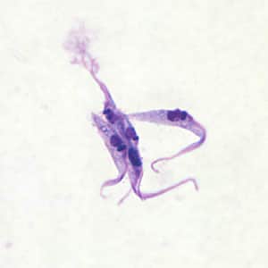 Tcruzi_culture_epi2.jpg Figure B: <em>Trypanosoma cruzi</em> epimastigotes from culture. Note the location of the kinetoplast anterior to the nucleus.