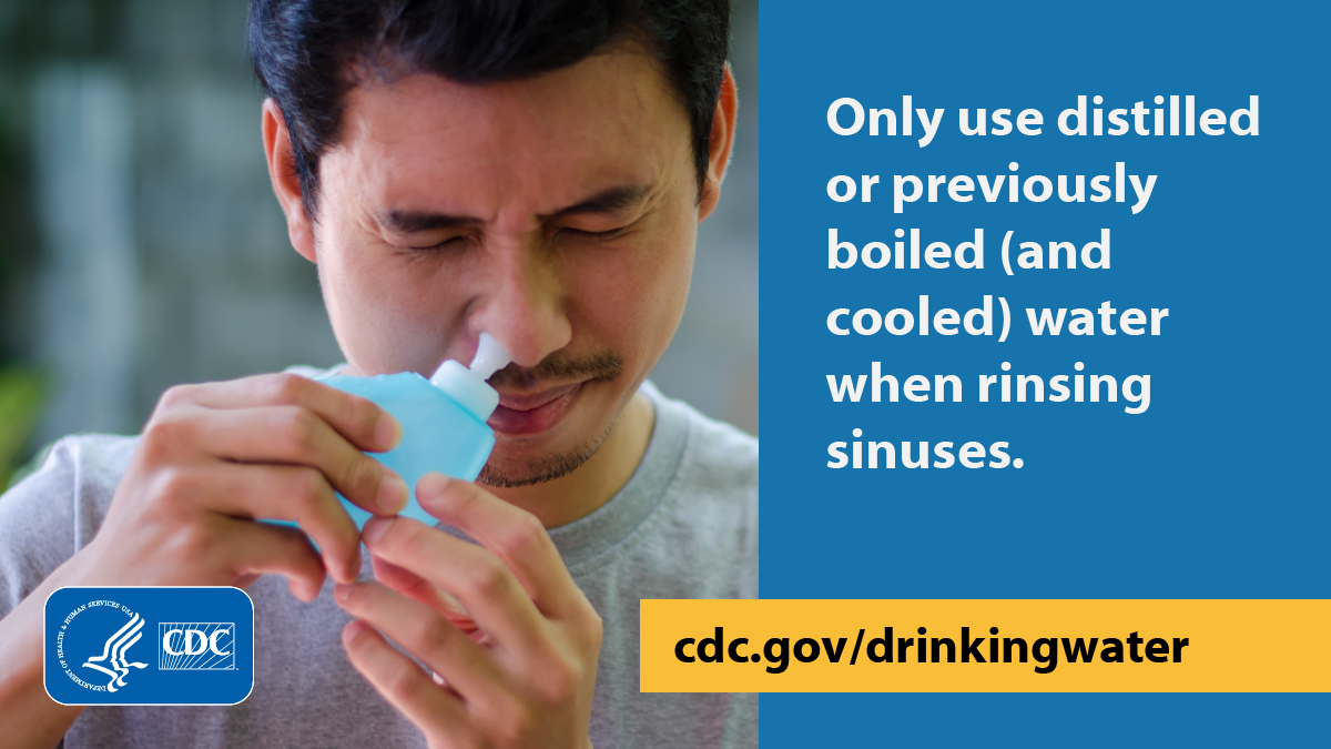 Person with their eyes closed putting a neti pot in their nostril. Text to the right of the image says, “Only use distilled or previously boiled (and cooled) water when rinsing sinuses.”