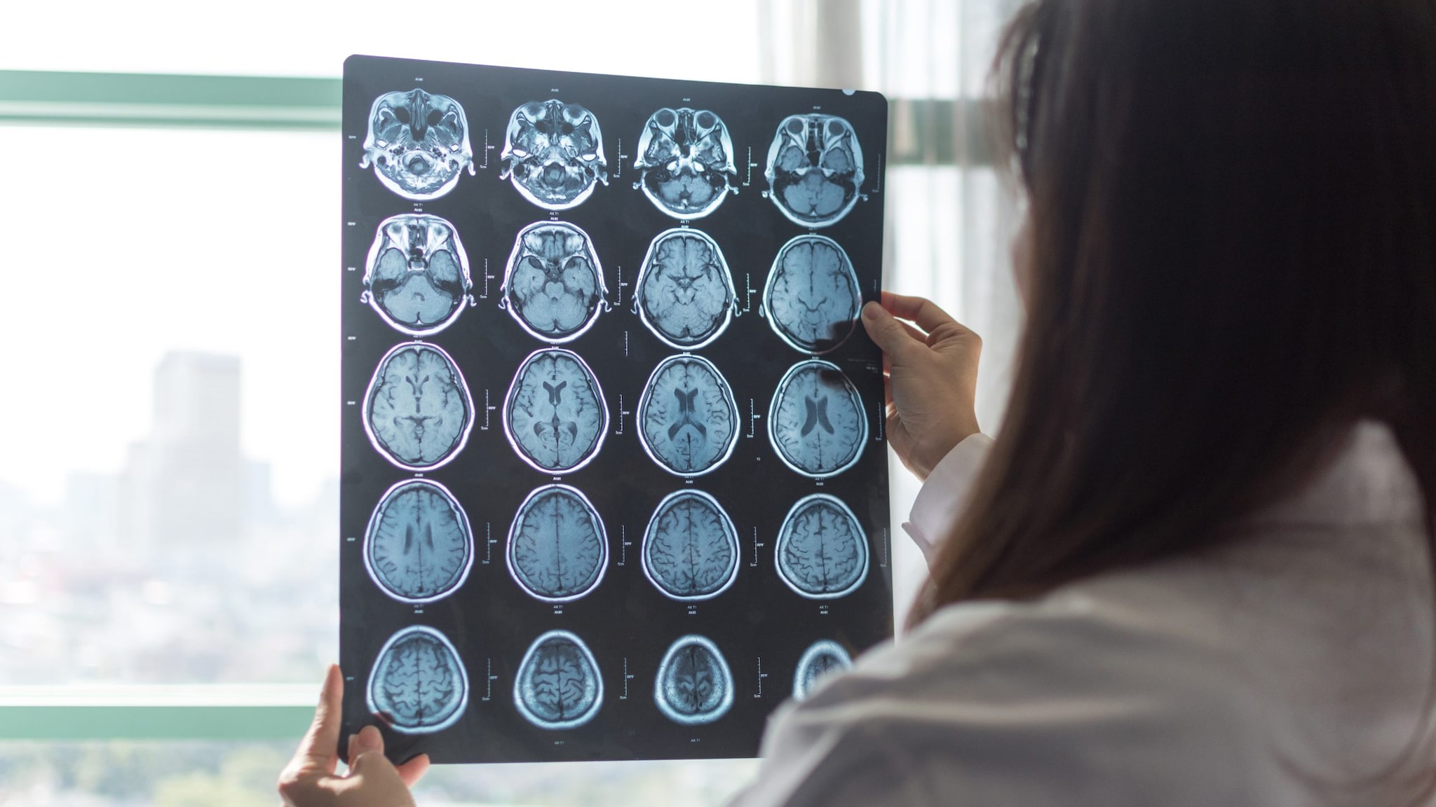 brain scan Doctor holding up a brain scan to a window