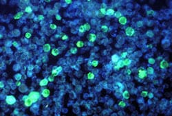 epstein-virus.jpg This photomicrograph depicts leukemia cells that contain Epstein-Barr virus using an FA staining technique.