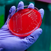 Image showing final stage of the bacterial culture process in red culture dish