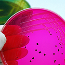 Culture-independent diagnostic tests (CIDTs) are changing the way that clinical laboratories diagnose patients with foodborne illness. These tests can identify the general type of bacteria causing illness within hours, without having to culture, or grow the bacteria in a laboratory.