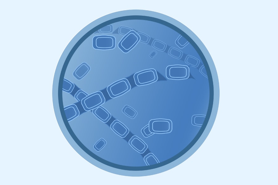 318301-A_WEB_FungalLandingPages_Cocci_About Ilustración médica de <em>Cocciodioides</em> spp.