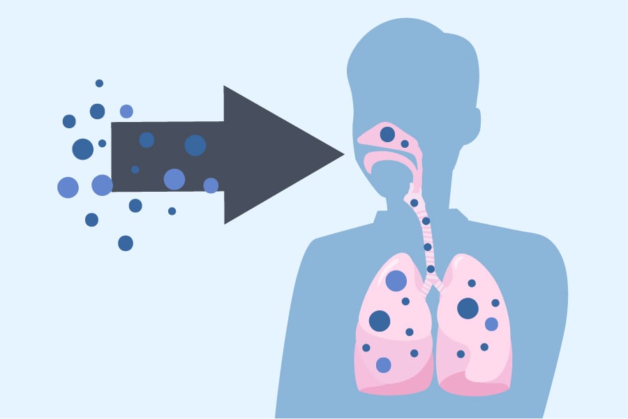 318301-A_WEB_FungalLandingPages_CNeoformans_Infection