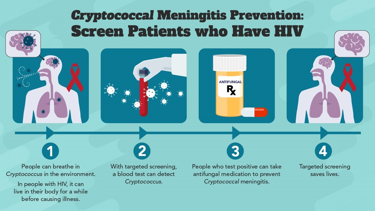 Cryptococcal meningitis prevention: screen patients who have HIV