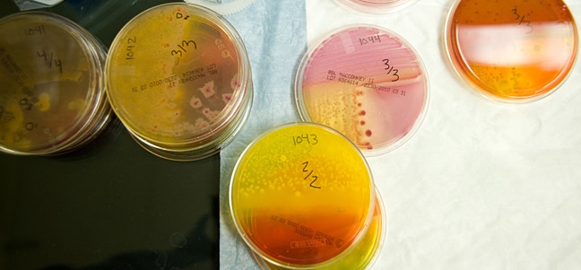 petri-dishes_648x301 Petri dishes showing microbe growth