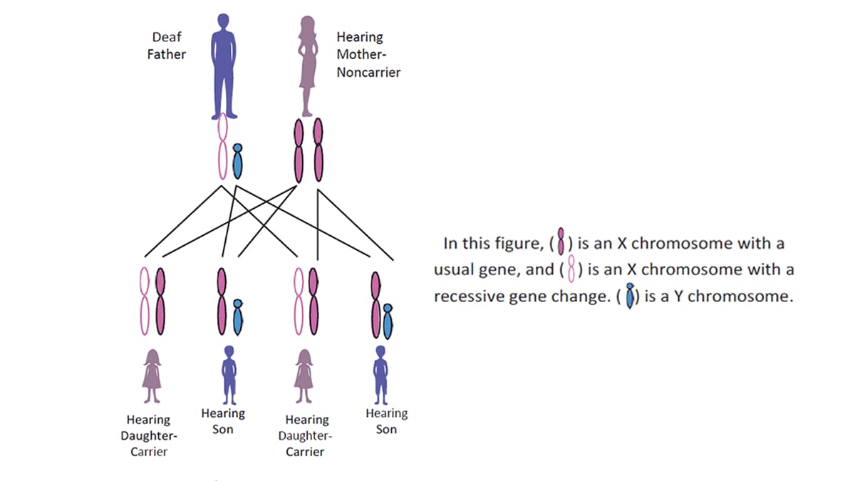 Figure of the chromosomes passed down from a deaf father and hearing mother who is a non-carrier of the recessive gene of deafness, to their children.