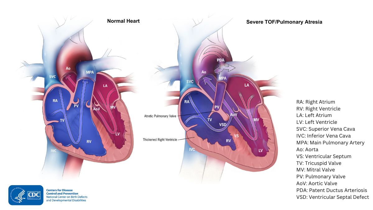 Heart illustration comparison