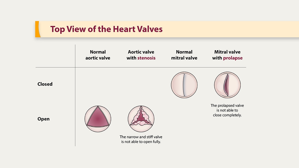 top-view-heart-valves Illustration of the top view of the heart valves.