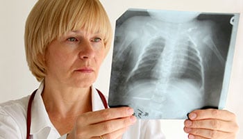 Healthcare provider x-ray Healthcare provider observing an x-ray of the chest.
