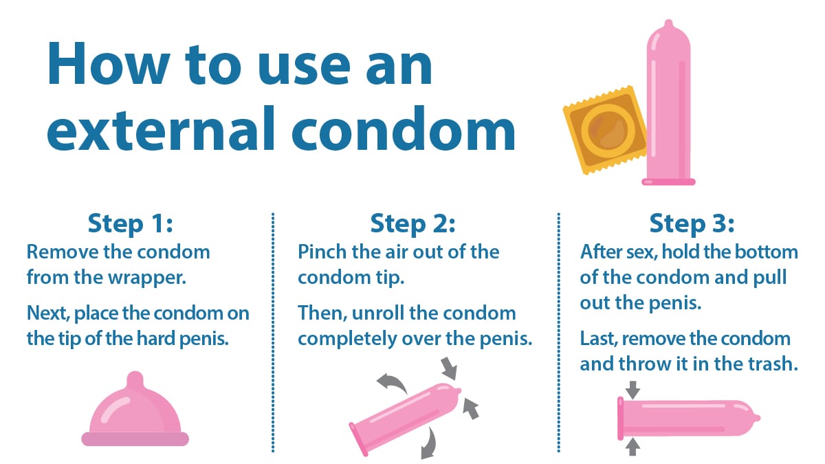 Image of how to use an external condom.