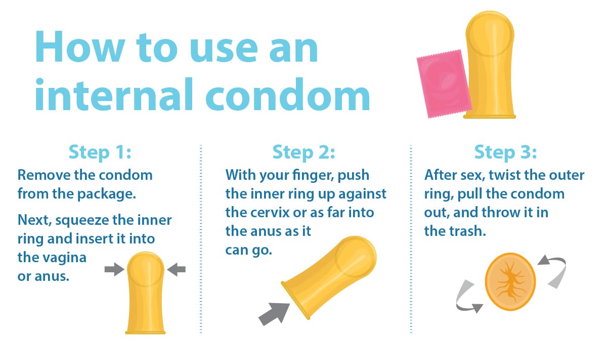 Image of how to use an internal condom.