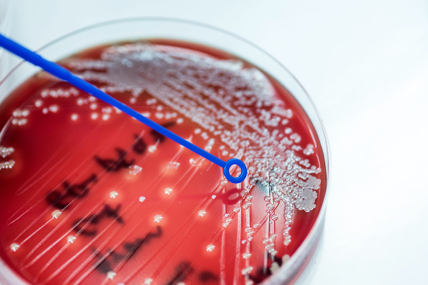 Coagulase-negative Staphylococcus (CoNS), a common skin commensal organism found in a blood culture bottle.