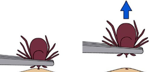 removal-ab.jpg clipart style image showing the proper removal of a tick using a pair of tweezers