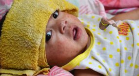 Sick child with compress on her forehead