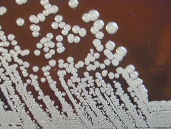 Image of burkholderia-pseudomallei stain.
