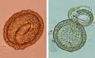 Left: Embryonated B. procyonis egg, showing the developing larva inside. Right: Larva of B. procyonis hatching from an egg.