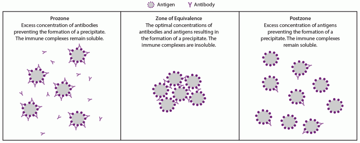 CDC Laboratory Recommendations for Syphilis Testing, United States, 2024 Figure illustrates the serologic effect of antibody and antigen concentrations on agglutination in the prozone, zone of equivalence, and postzone following treatment for syphilis.