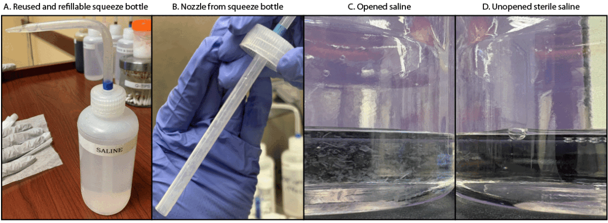Pseudo-Outbreak of Purpureocillium lilacinum Skin Infections at a Dermatology Clinic — Washington, 2024 The figure comprises three photographs taken by Washington State Department of Health in 2024, showing a refillable squeeze bottle contaminated with Purpureocillium lilacinum, a cap and nozzle from a refillable squeeze bottle, and opened and unopened saline bottles used to refill squeeze bottles.