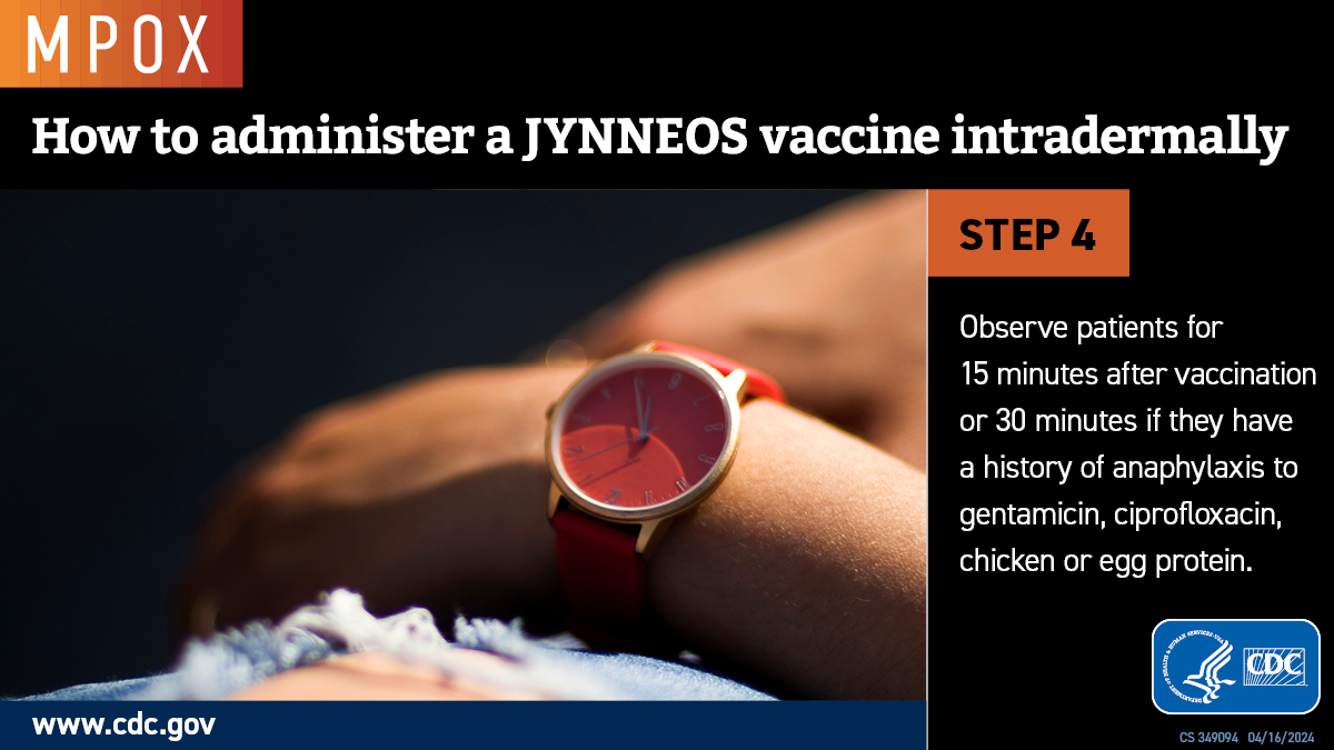 Photo of a red watch on a wrist.