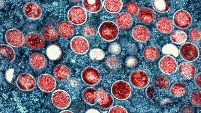 A colorized transmission electron microscopic image of monkeypox virus particles, found within an infected cell