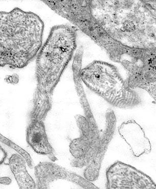 disease_mumps.jpg This 1977 thin sectioned transmission electron micrograph (TEM) depicted the ultrastructural details of the mumps virions that had been grown in a Vero cell culture.