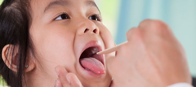 Un médico examina la garganta de una niña con paperas
