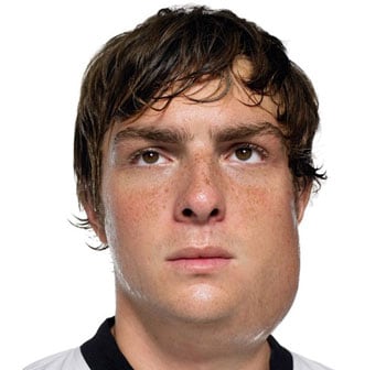 mumps_b250px Adult with swollen salivary gland from mumps