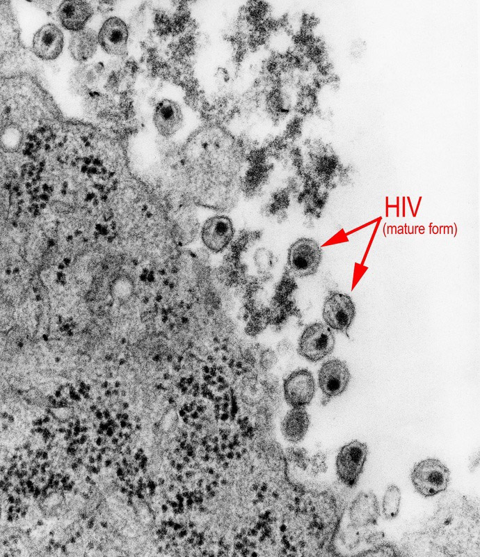 hiv-micrograph hiv-micrograph